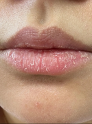 被闺蜜追着问的润唇膏，Blistex 百蕾适莹润保湿润唇膏到底有多绝！